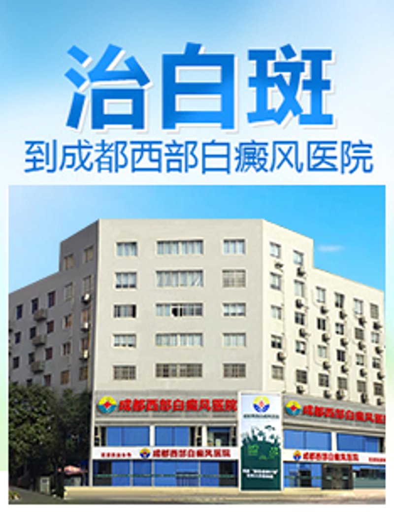 成都西部白癜风