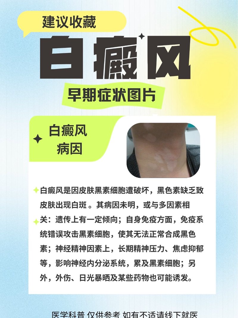 在2025年,面对白癜风这一令人困扰的皮肤病,我们整理了一份详细的治疗指南。这份指南不仅涵盖了最新的治疗方法,还结合了实际案例分析,帮助患者和家属更好地了解如何应对这一疾病。
