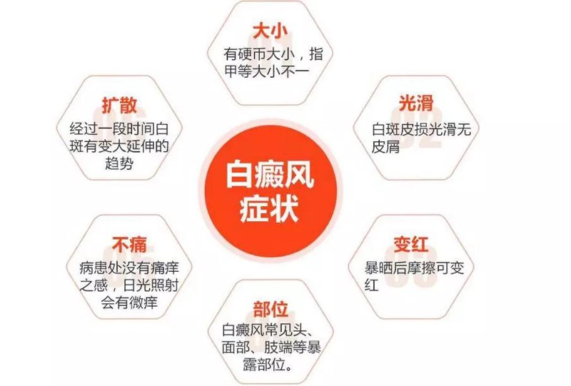 白癜风治疗,你还在迷茫吗?2025版治疗指南来啦!