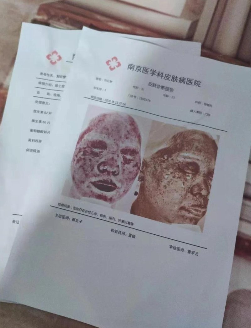 如何战胜白癜风?2025版治疗指南